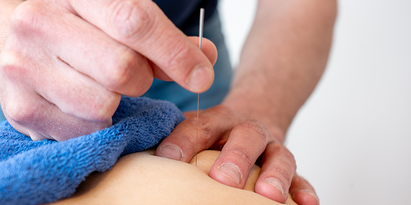 Dry needling behandelmethodes